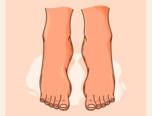 Trombose: A Doença Que a Medicina Está Resolvendo com Novas Abordagens!