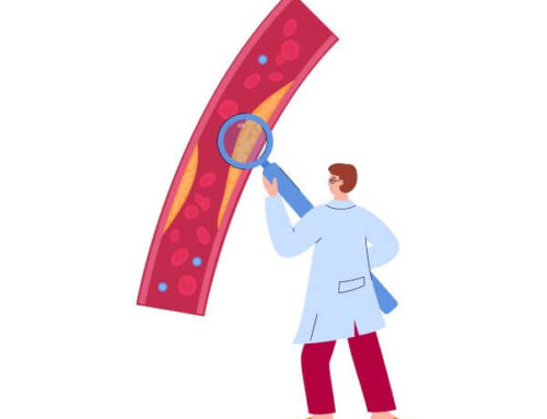 Varizes: O Guia Definitivo sobre Causas, Sintomas e Tratamentos Modernos (2026)